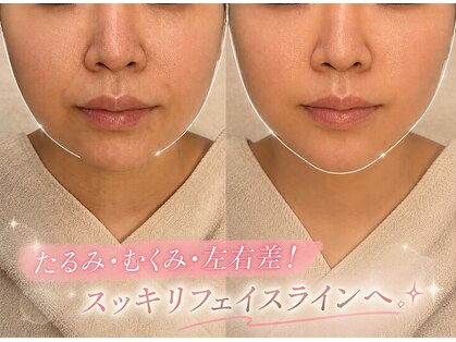 ステラ グランデ 福岡博多の写真