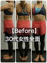 24ダイヤモンドジム(24 DIAMOND GYM)/【Before】30代女性全面