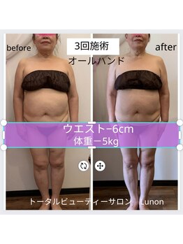 ルノン(LUNON)/温熱リンパで短期間本気痩せ！