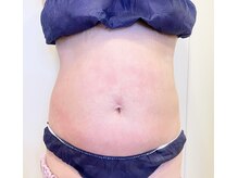 リフティングラボ(LIFTING LAB)/脂肪撃退＆超強力筋トレ