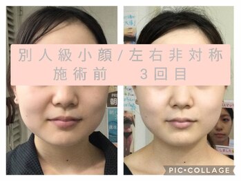 エクラ(Eclat)/小顔+肌質改善+たるみケア専門