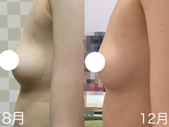 ハレオラ(HaleOla)/20代☆遠方の方はオンラインで♪