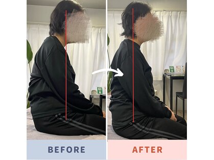 マクシル(MAXIL)の写真