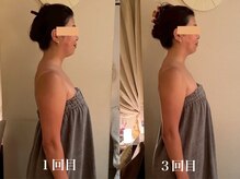 カオン(kaon)/ブライダルエステ3回のお客様