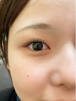 ビヨウシツチャーリー/ブラウン100本