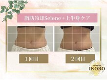 ミナ アン イコロ(mina an IKORO)の雰囲気（【無・痛｜脂肪冷却】札幌初導入！目元冷却可能◎脂肪細胞撃退！）