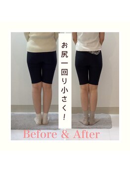 スタイルラボ高松/産後骨盤矯正の効果♪