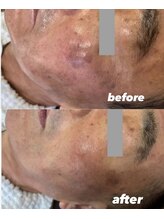 ビビット 久宝寺店(VIVIT)/肌質改善/シミシワたるみエステ