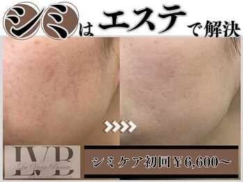 ラヴレボーテ(La Vraie Beaute)