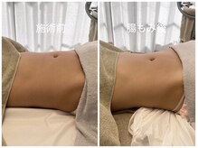 カナロア(Kanaloa)/HOT腸もみ★痩身/マッサージ