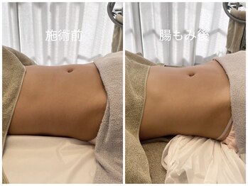 カナロア(Kanaloa)/HOT腸もみ★痩身/マッサージ