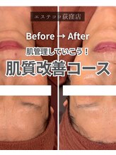 エステ ココ 荻窪店(Esthe CoCo)/美肌/肌管理/毛穴