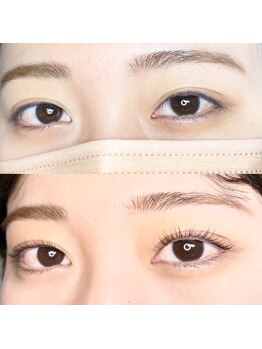 フィグ(fig)/ラッシュリフト