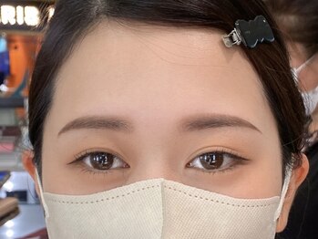 ビューティーガーデン イース/AFTER