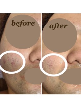 ディア(DIA)/【メンズもOK♪】