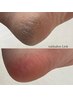 みるみる変わる…！フット角質ケア
