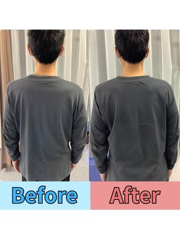 ほずみ整体院/50代男性　姿勢改善