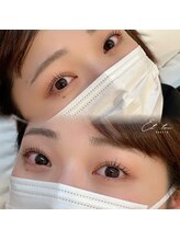 エトワボーテ(Et toi beaute)/人気No.1 ラッシュリフト