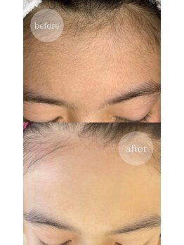 アンドエピ(&epi)/