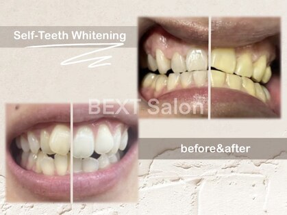 ベクスト(BEXT)の写真