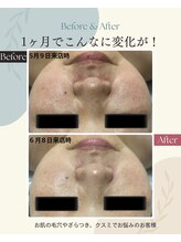 ラン(Ran)/今のトラブルお肌から脱出