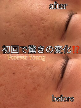 ピエル 北千住店(PIEL)/フォーエバーヤング