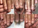 育成ネイル