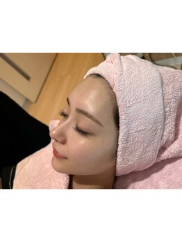 美白ケアをしたい