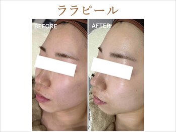 ティアム バイ テトテ 神戸三宮(TIAM by tetote)/ララピール