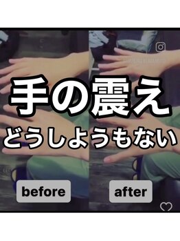 カワル整体 上通り院/どうしようもない手の震え