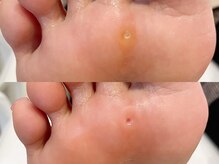 キラネイル アンド アイラッシュ by World Beauty(KIRA)/フットケア