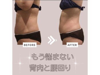 ソワン(Soin)/40代　お腹