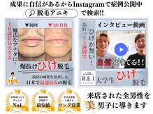 レイ(R.E.I)/自信があるから施術事例公開中♪