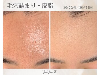 スリースリー(THREE THREE)/毛穴詰まり・皮脂ケア