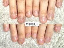 グラシナ なんば店/深爪/噛み/むしり癖/長さ出し