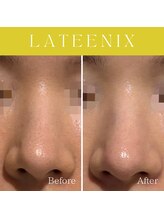 ハナイロ(hana-iro)/ラティニックス管理