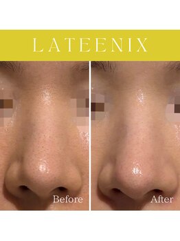 ハナイロ(hana-iro)/ラティニックス管理