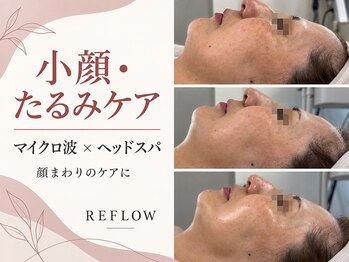 リフロー(REFLOW)の写真/成人式・結婚式・前撮り前の小顔ケアに