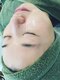 カスミ板橋ベルミーランドの写真/【紫外線/乾燥などで受ける肌トラブルに◎】幹細胞美容液+微細針ピーリングで季節性の肌悩みも解消へ♪