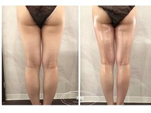 美極 銀座店/銀座/小顔コルギ/小顔矯正