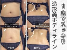 トレス(Tres)の雰囲気（【インディバ社認定サロン】術後ケア・疲労回復～ダイエットまで）