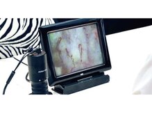 美容整骨小顔ラボ/血管血流観測