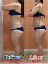 ハンズ鍼灸接骨院小牧院 美容整体ハンズ(美容整体hands)/ハイパーナイフ 美脚