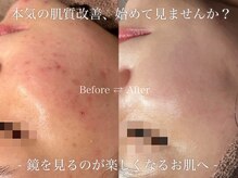 肌管理はルースにお任せ下さい♪