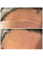 ルーム303(Room303)/お顔のワックスで清潔感アップ！