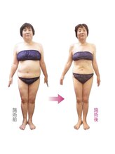 フジグラン安芸ベルミーランド/痩身before→after