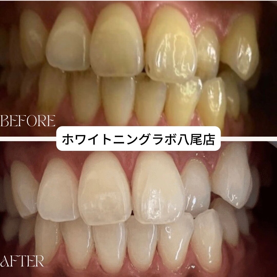 ホワイトニングラボ 八尾店(Whitening Labo)｜ホットペッパービューティー