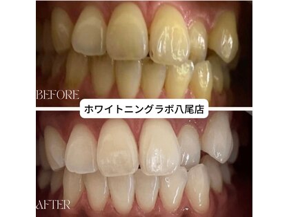 ホワイトニングラボ 八尾店(Whitening Labo)の写真