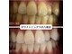 ホワイトニングラボ 八尾店(Whitening Labo)の写真