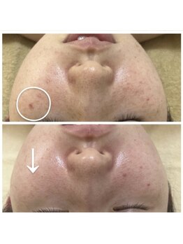 ルルボーテ(Loulou Beaute)/イラストリアス